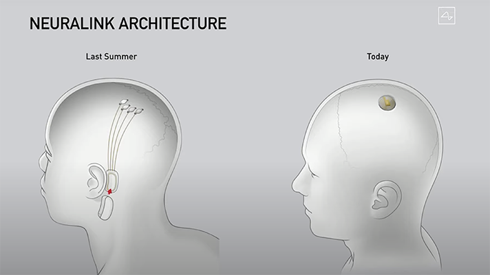 https://www.mobihealthnews.com/sites/default/files/Neuralink.png